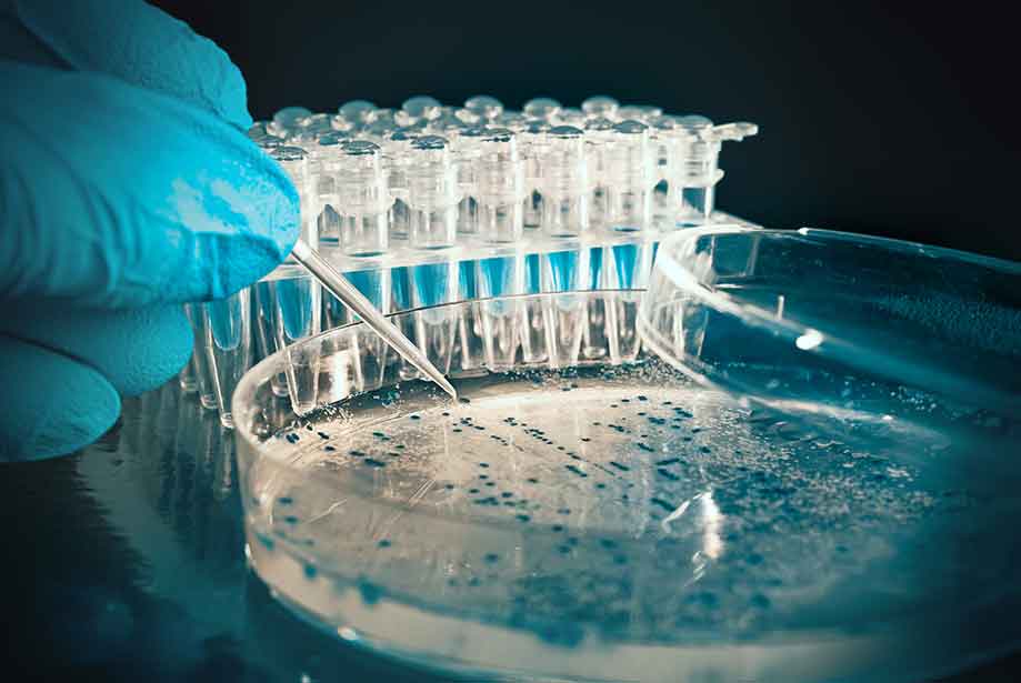 CD38_Purified, Clon LD38, Isotype IgG1